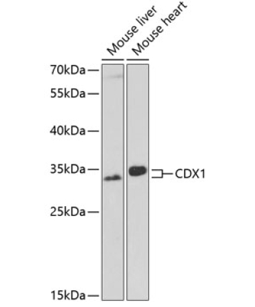 CDX1 Rabbit Polyclonal Antibody