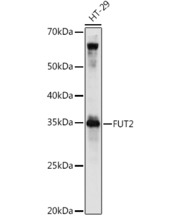 FUT2 Rabbit Polyclonal Antibody