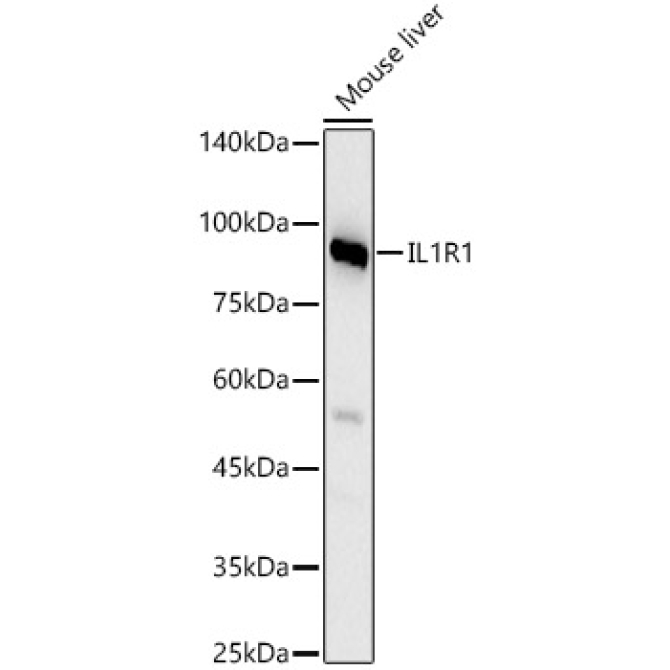 IL1R1 Rabbit Polyclonal Antibody