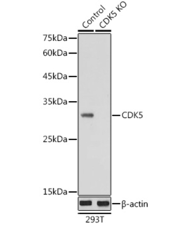 CDK5 Rabbit Polyclonal Antibody [KO Validated]
