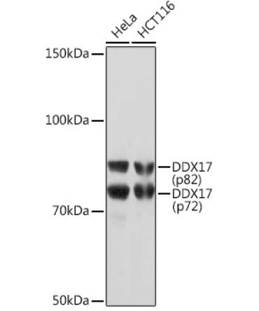 DDX17 Rabbit Monoclonal Antibody