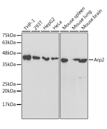 Arp2 Rabbit Polyclonal Antibody
