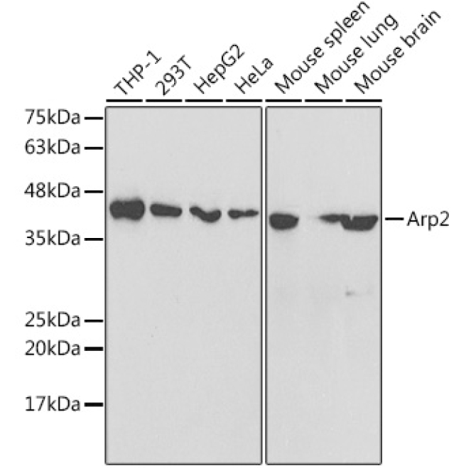 Arp2 Rabbit Polyclonal Antibody