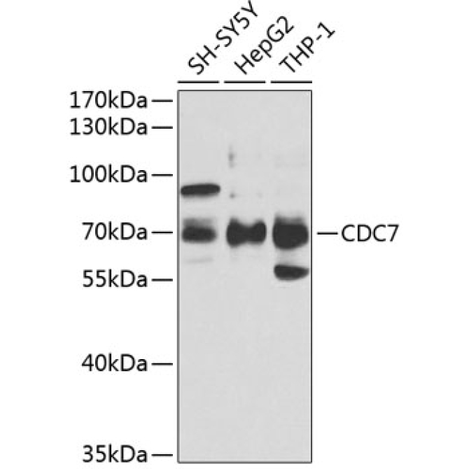 CDC7 Rabbit Polyclonal Antibody