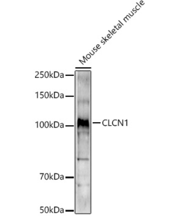 CLCN1 Rabbit Polyclonal Antibody