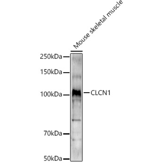 CLCN1 Rabbit Polyclonal Antibody