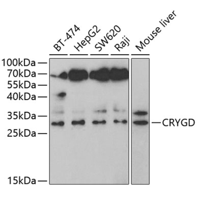 CRYGD Rabbit Polyclonal Antibody