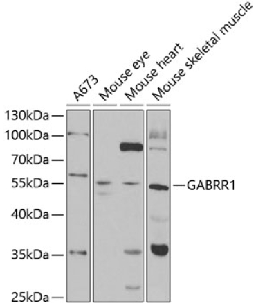 GABRR1 Rabbit Polyclonal Antibody