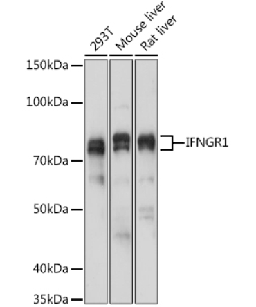 IFNGR1 Rabbit Polyclonal Antibody