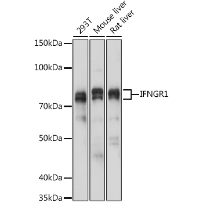 IFNGR1 Rabbit Polyclonal Antibody