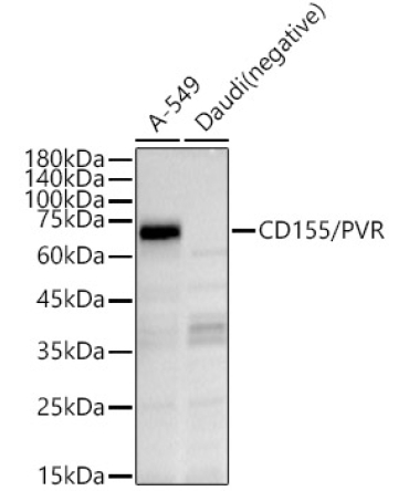 CD155/PVR Rabbit Polyclonal Antibody