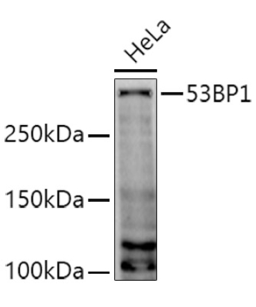 53BP1 Rabbit Polyclonal Antibody