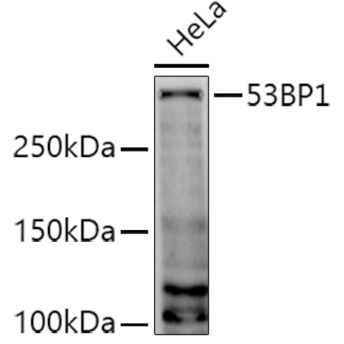 53BP1 Rabbit Polyclonal Antibody
