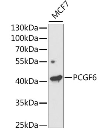 PCGF6 Rabbit Polyclonal Antibody
