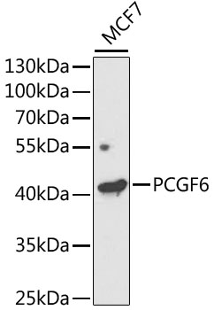 PCGF6 Rabbit Polyclonal Antibody