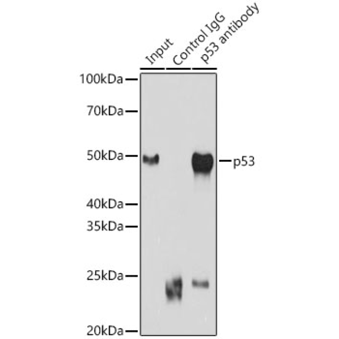 p53 Rabbit Polyclonal Antibody