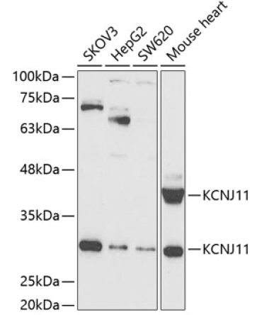 KCNJ11 Rabbit Polyclonal Antibody