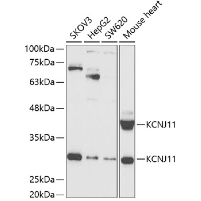 KCNJ11 Rabbit Polyclonal Antibody