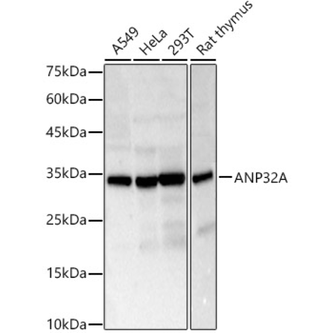 ANP32A Rabbit Polyclonal Antibody