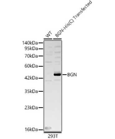 BGN Rabbit Polyclonal Antibody