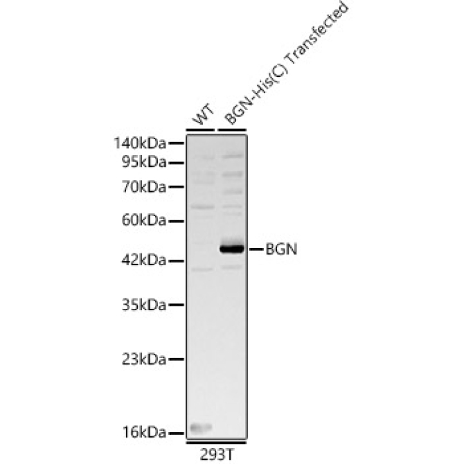 BGN Rabbit Polyclonal Antibody