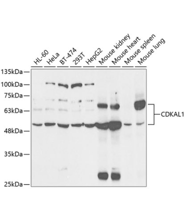 CDKAL1 Rabbit Polyclonal Antibody