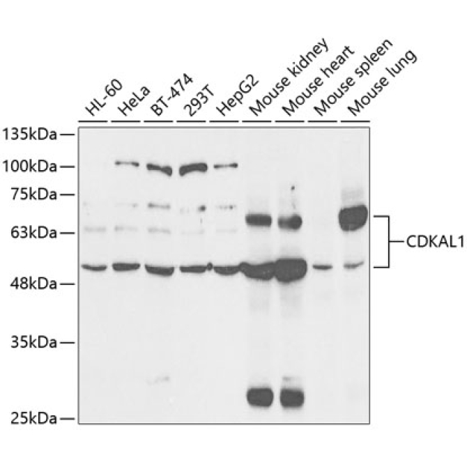CDKAL1 Rabbit Polyclonal Antibody