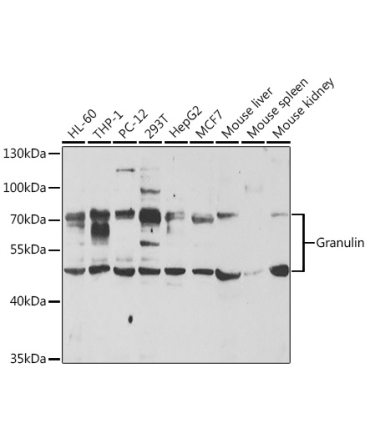 Granulin Rabbit Polyclonal Antibody