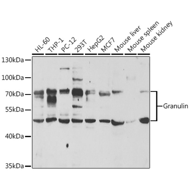 Granulin Rabbit Polyclonal Antibody