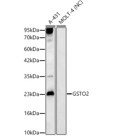 GSTO2 Rabbit Polyclonal Antibody