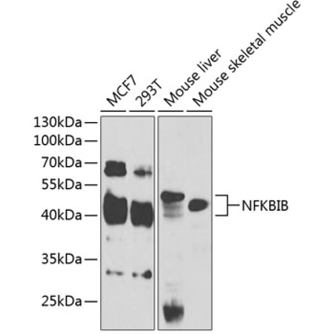 NFKBIB Rabbit Polyclonal Antibody
