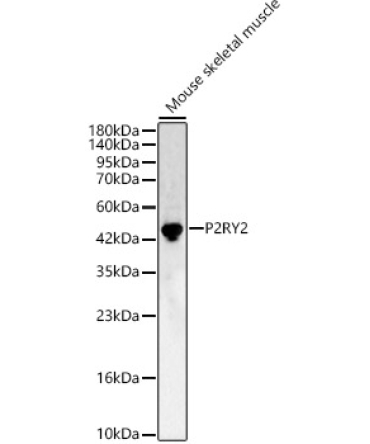 P2RY2 Rabbit Polyclonal Antibody