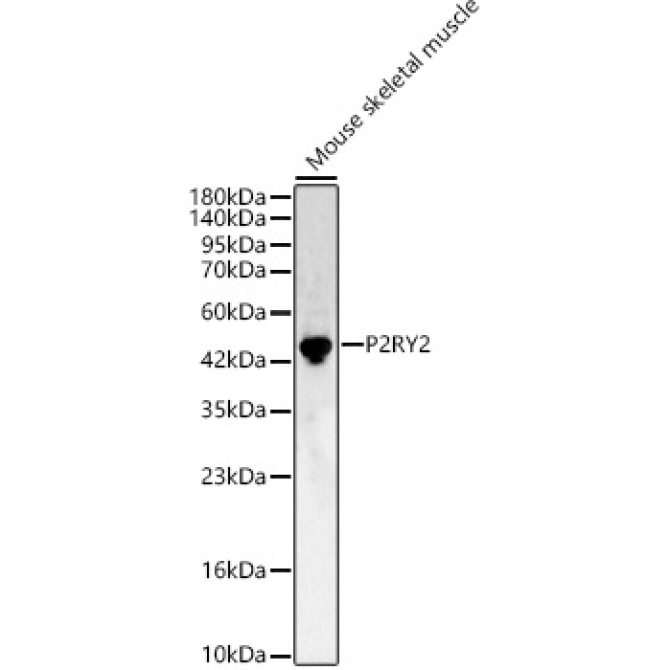 P2RY2 Rabbit Polyclonal Antibody