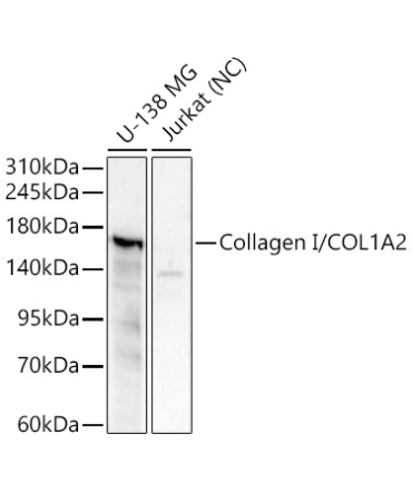 Collagen I/COL1A2 Rabbit Polyclonal Antibody