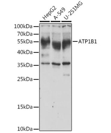 ATP1B1 Rabbit Polyclonal Antibody