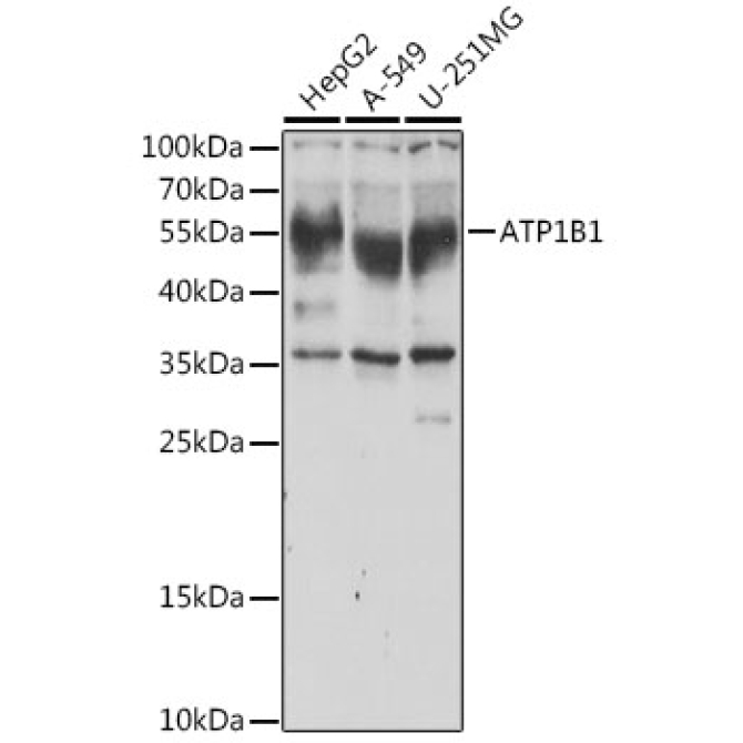 ATP1B1 Rabbit Polyclonal Antibody