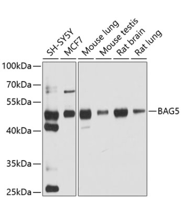 BAG5 Rabbit Polyclonal Antibody