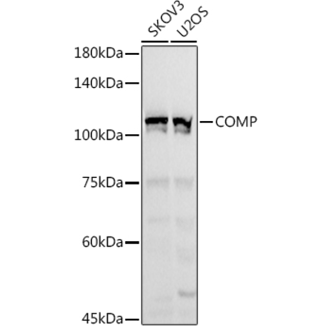COMP Rabbit Polyclonal Antibody
