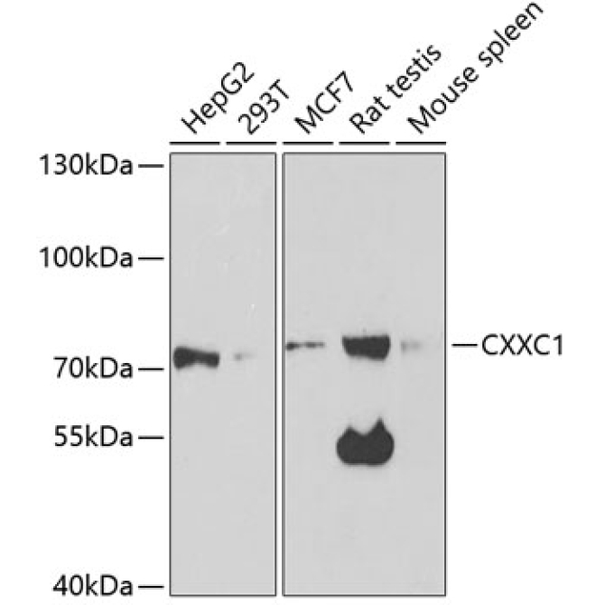 CXXC1 Rabbit Polyclonal Antibody
