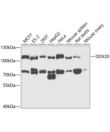DDX20 Rabbit Polyclonal Antibody