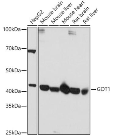 GOT1 Rabbit Polyclonal Antibody