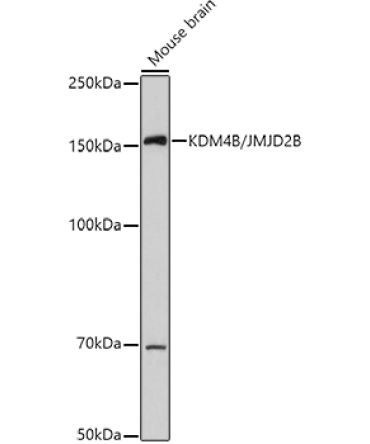 KDM4B/JMJD2B Rabbit Polyclonal Antibody
