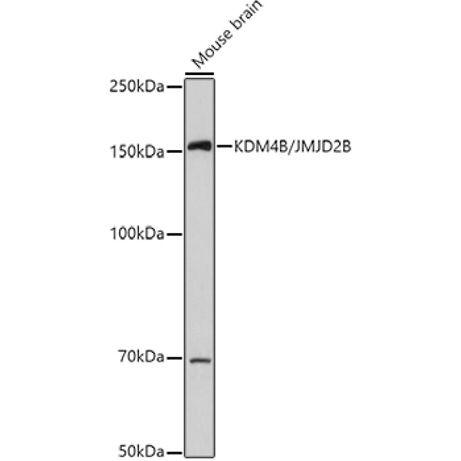 KDM4B/JMJD2B Rabbit Polyclonal Antibody