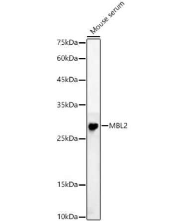 MBL2 Rabbit Polyclonal Antibody