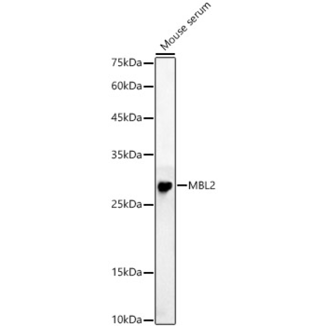 MBL2 Rabbit Polyclonal Antibody