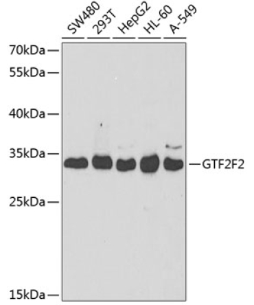 GTF2F2 Rabbit Polyclonal Antibody