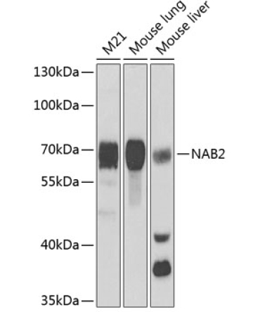 NAB2 Rabbit Polyclonal Antibody