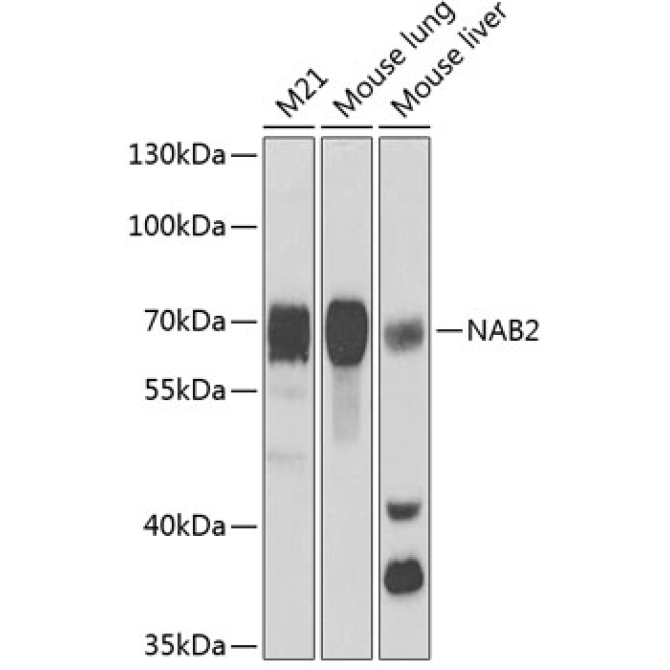 NAB2 Rabbit Polyclonal Antibody