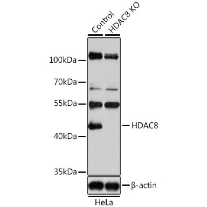 HDAC8 Rabbit Polyclonal Antibody [KO Validated]