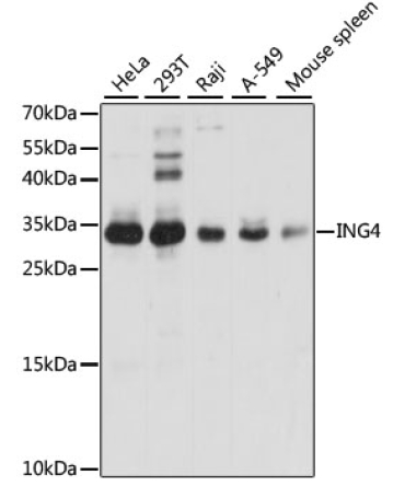 ING4 Rabbit Polyclonal Antibody